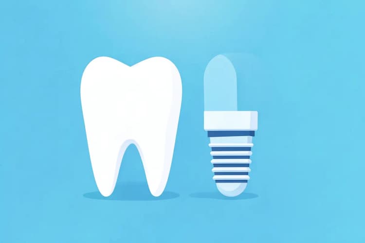 Dente humano isolado com um pino de implante ao lado, sobre superfície limpa.